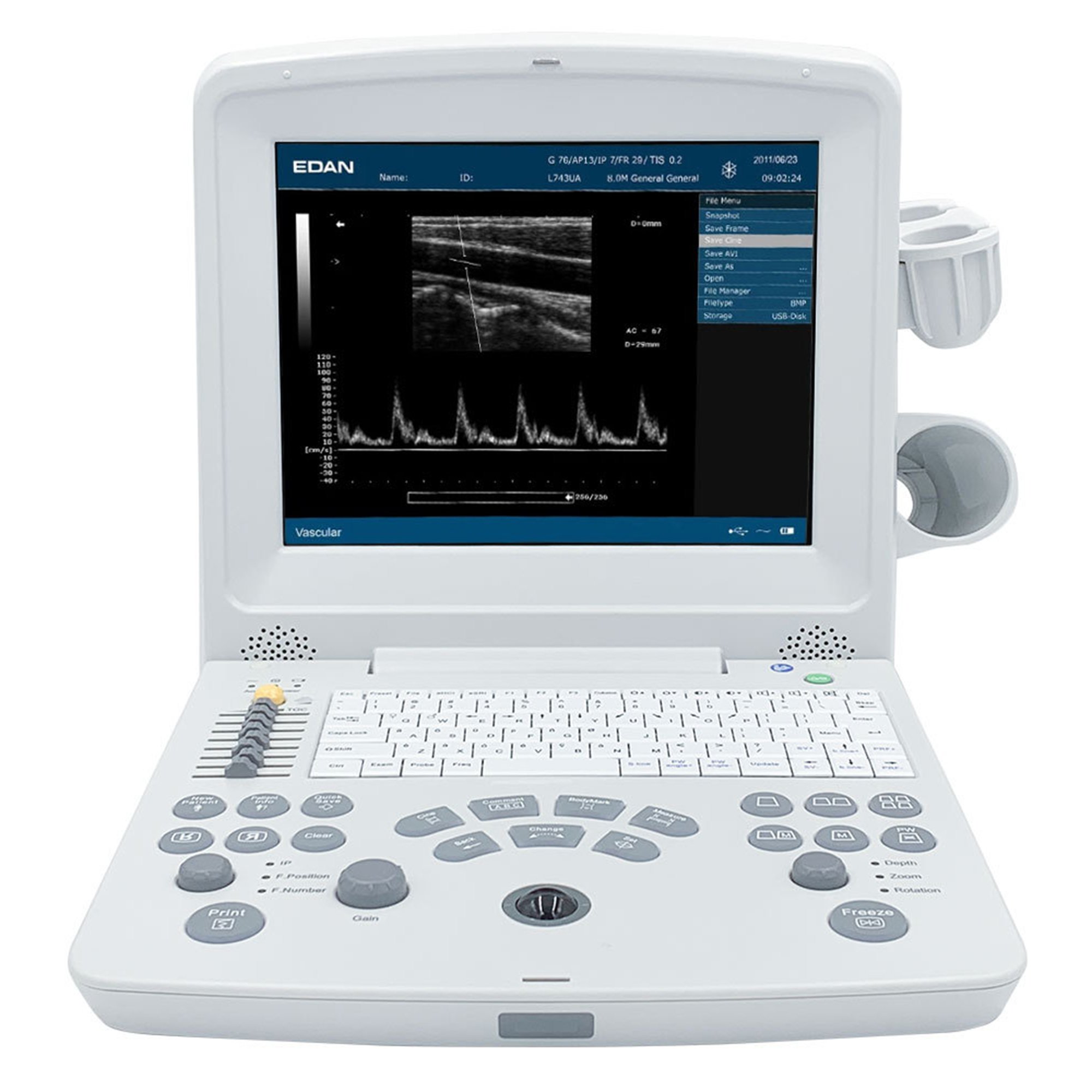 Ultrasound System DUS 60 256 Frame Cine Loop Memory, 504 MB Built-In Image Storage, Two USB ports, 7 Types Pseudo Color, 100 to 240 V, 50 to 60 Hz Power Supply by MDPro Edan USA  ID DUS60